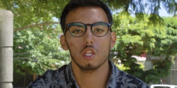 Lucas Robles, joven con síndrome de Moebius