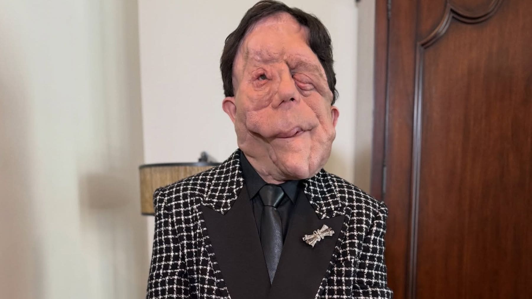 Adam Pearson visibiliza su enfermedad rara en la alfombra roja de la gala de los Premios Oscar