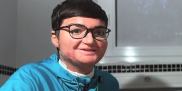 Adrián Soto, joven con Piel de Mariposa