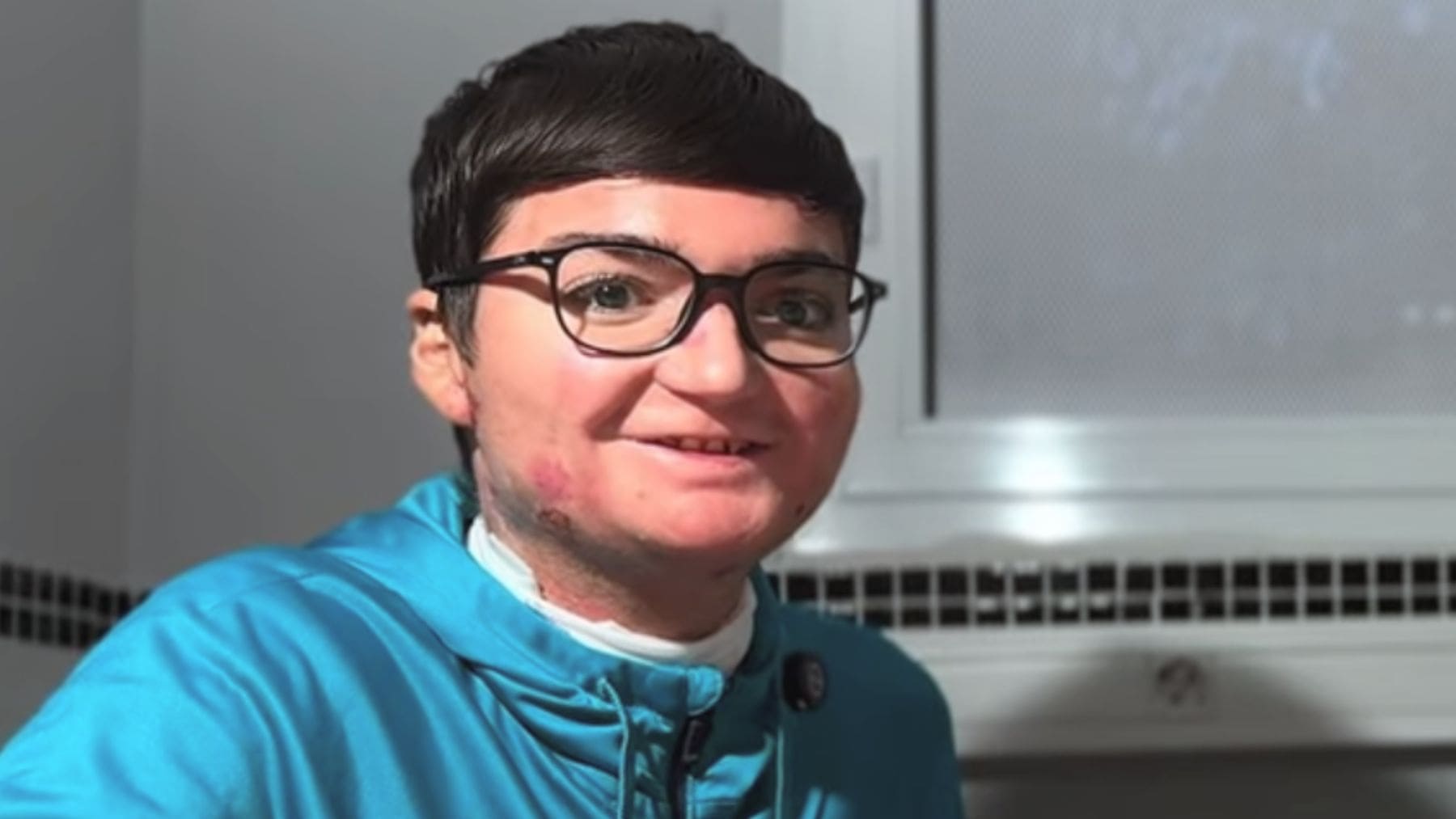 Adrián Soto será la primera persona de España en recibir ‘Vyjuvek’, tratamiento para la Piel de Mariposa