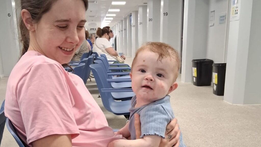 El día a día de familias con Piel de Mariposa: "Me temblaban las manos; no podía taparle la herida"