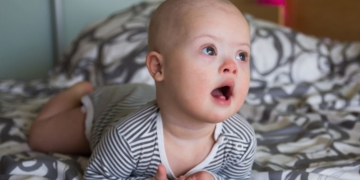 Diagnóstico prenatal de síndrome de Down: un contraste de emociones, apoyos y una sonrisa permanente