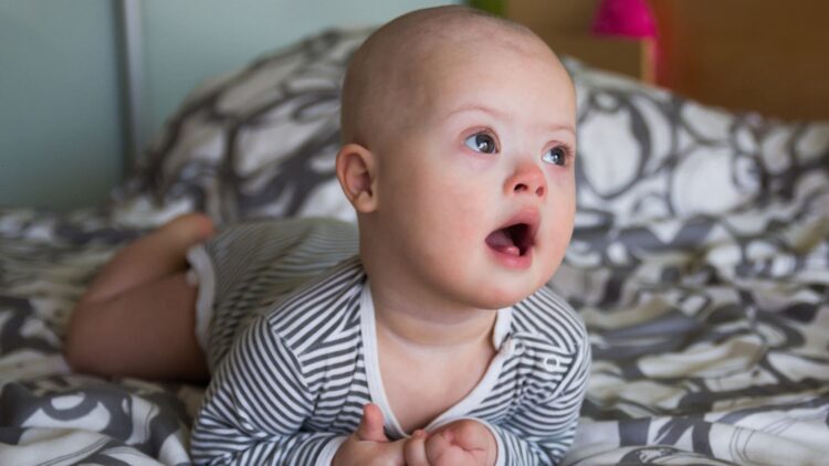 Diagnóstico prenatal de síndrome de Down: un contraste de emociones, apoyos y una sonrisa permanente