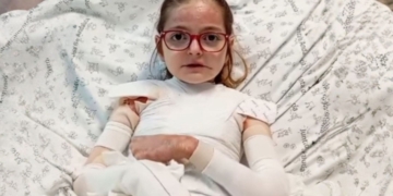 Laura, niña sevillana con Piel de Mariposa