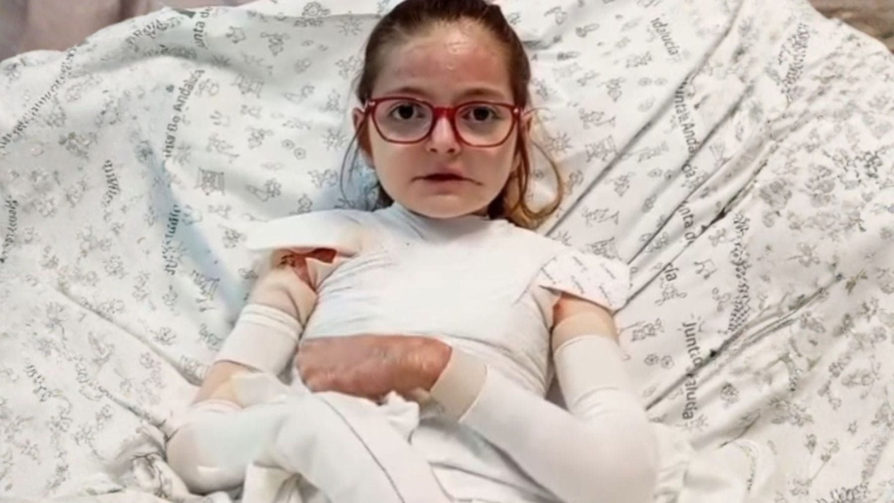 Laura, niña sevillana con Piel de Mariposa