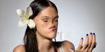 Nicole Monsalve, una artista con síndrome de Bosma que derriba barreras con su voz