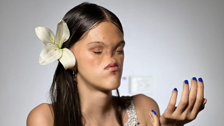 Nicole Monsalve, una artista con síndrome de Bosma que derriba barreras con su voz