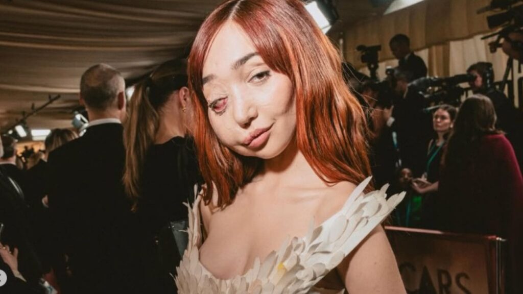La activista e influencer Nikky Lilly normaliza su enfermedad rara en la alfombra roja de los Oscar