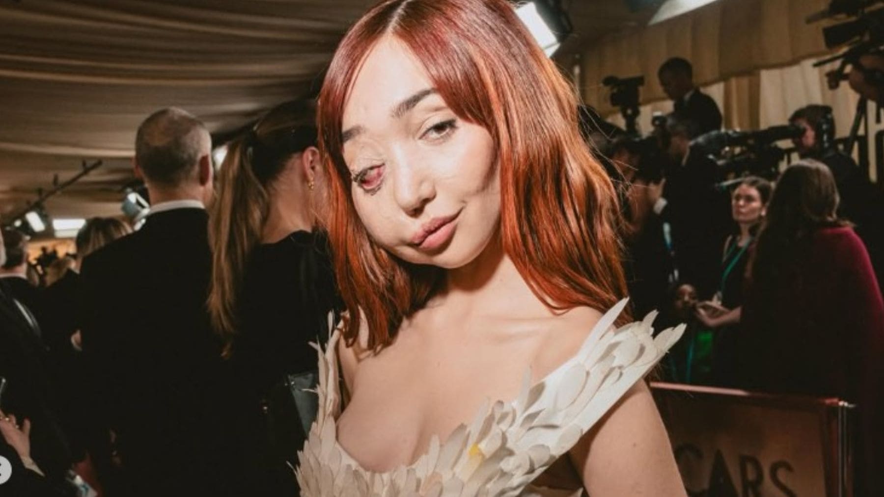 La activista e influencer Nikky Lilly normaliza su enfermedad rara en la alfombra roja de los Oscar