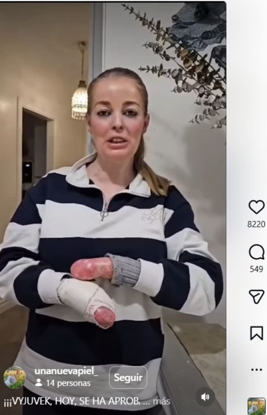 Los pacientes de Piel de Mariposa en Andalucía celebran la aprobación de 'Vyjuvek' por la Junta