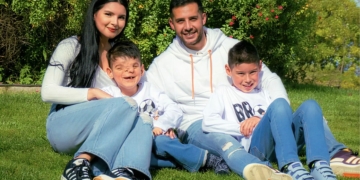 Thiago, un niño de 10 años con una extraña malformación craneofacial