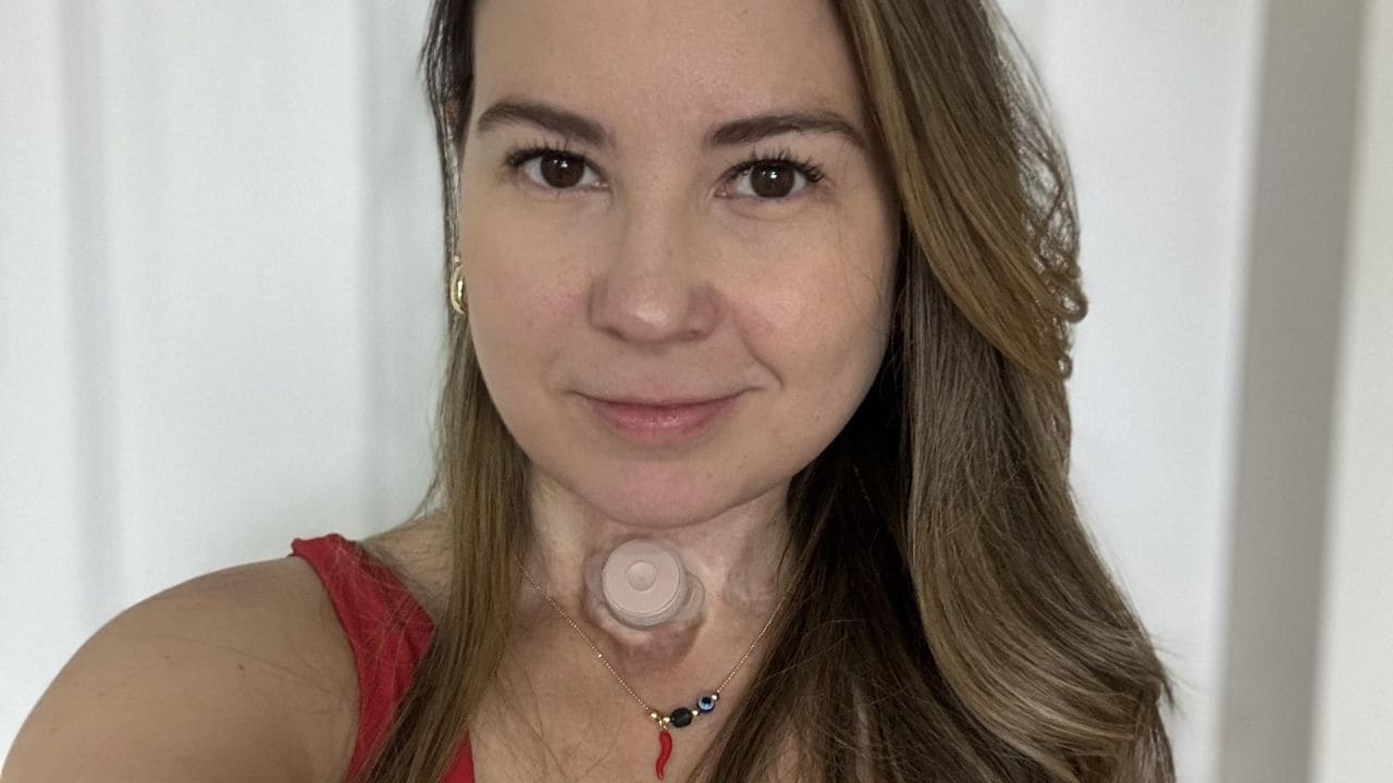 Alexandra Pérez, 16 años de una vida laringectomizada