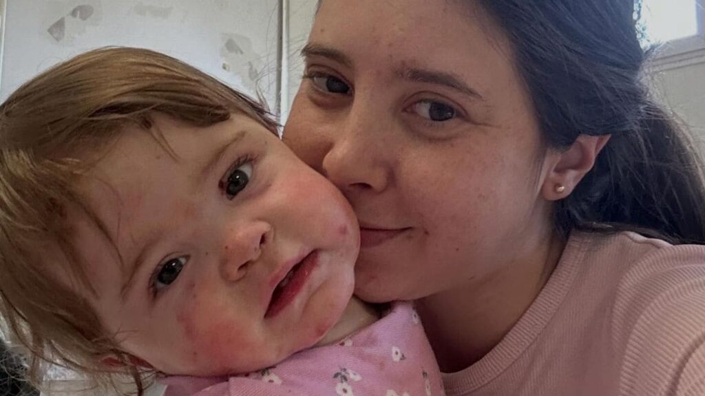Ana Domenech, divulgadora y madre de una niña con Piel de Mariposa