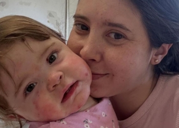 Ana Domenech, divulgadora y madre de una niña con Piel de Mariposa