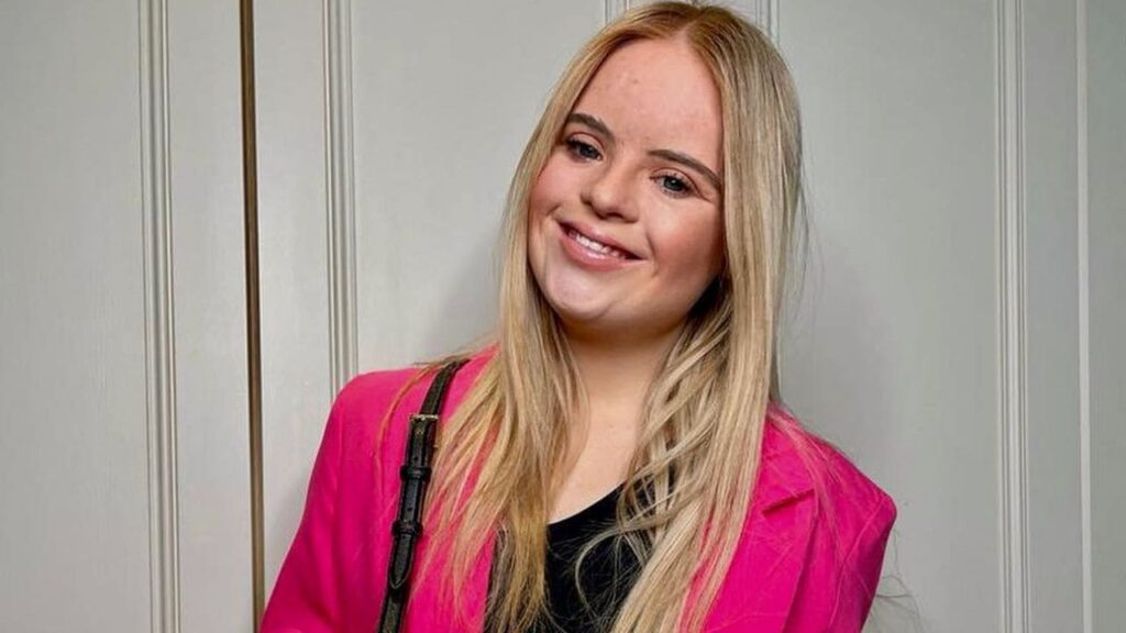 Kate Grant, primera modelo con síndrome de Down de Irlanda y Reino Unido