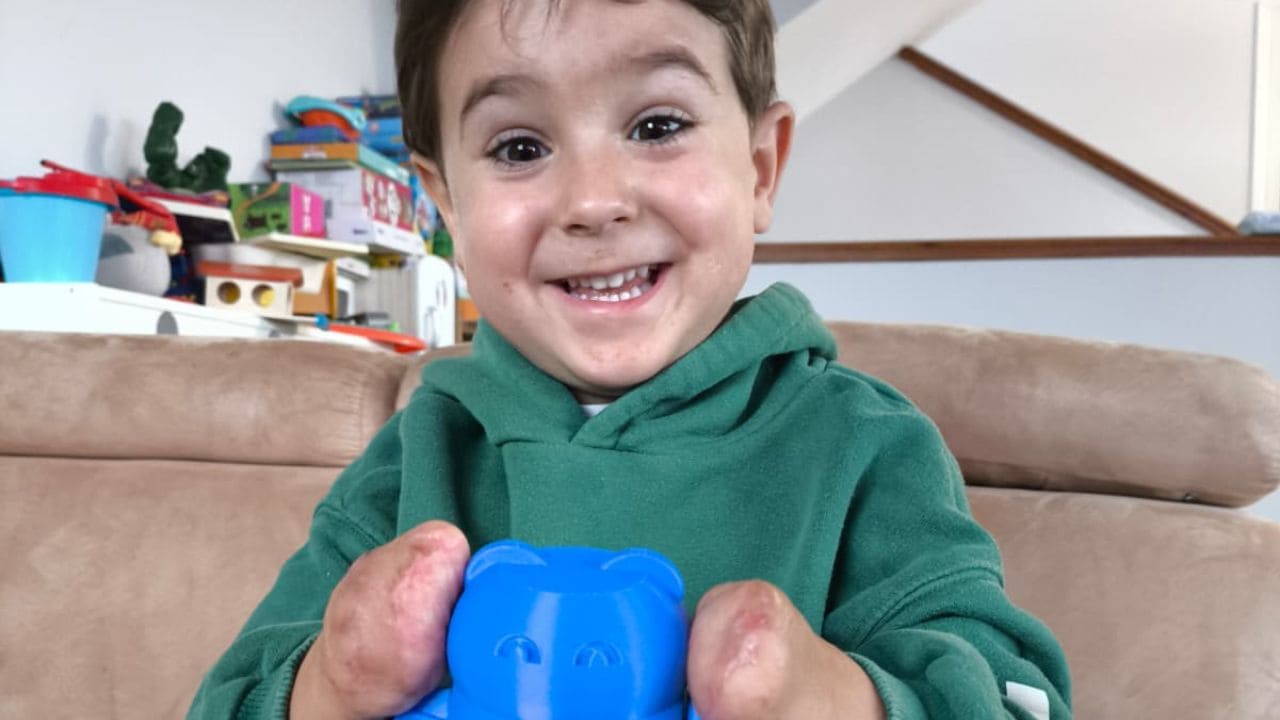 El detalle de los bomberos de Gijón con Mael, un niño que perdió brazos y piernas por una meningitis
