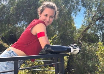 Sarah Almagro explica la elección de prótesis o silla de ruedas en pacientes amputados