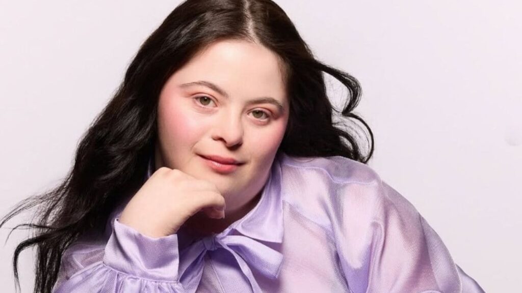 Ellie Goldstein, la primera modelo con síndrome de Down en aparecer en la portada de ‘VOGUE’