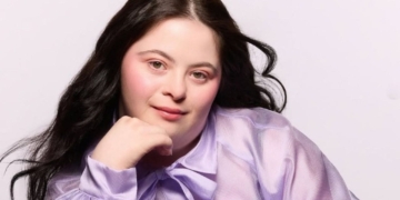 Ellie Goldstein, modelo con síndrome de Down