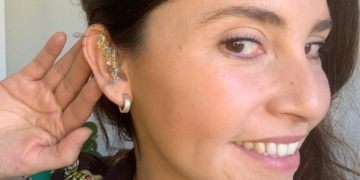 Aylin Morales, mujer sorda con implante coclear