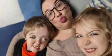 Cómo afecta el diagnóstico de una enfermedad rara de un hijo en la salud mental de una madre