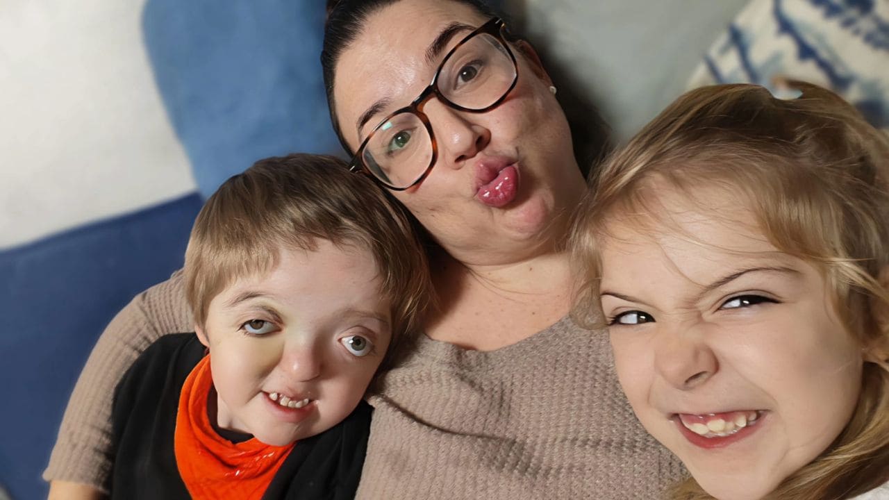 Cómo afecta el diagnóstico de una enfermedad rara de un hijo en la salud mental de una madre