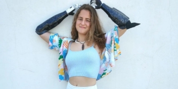Sarah Almagro anima a sopesar las ventajas de un trasplante de mano