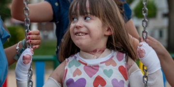Victoria, niña cordobesa con Piel de Mariposa