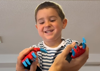 Mael recibe una prótesis de manos de 'Spiderman' de 'Ayudame 3D