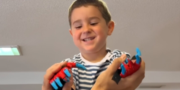 Mael recibe una prótesis de manos de 'Spiderman' de 'Ayudame 3D