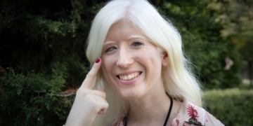 Patty Bonet, actriz y periodista con discapacidad visual