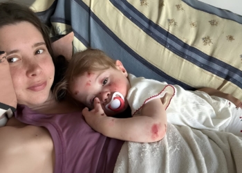 Ana Domenech y su hija Julia, con Piel de Mariposa