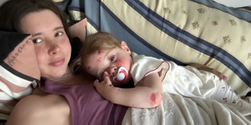 Ana Domenech y su hija Julia, con Piel de Mariposa