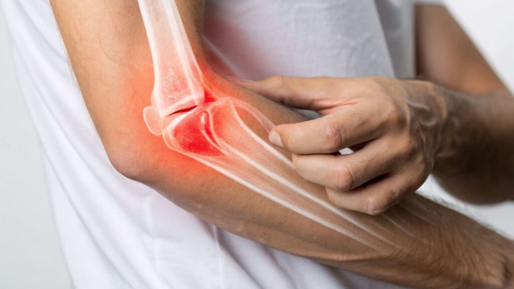 Logra una pensión por incapacidad permanente por tendinitis y artrosis tras el rechazo inicial del INSS