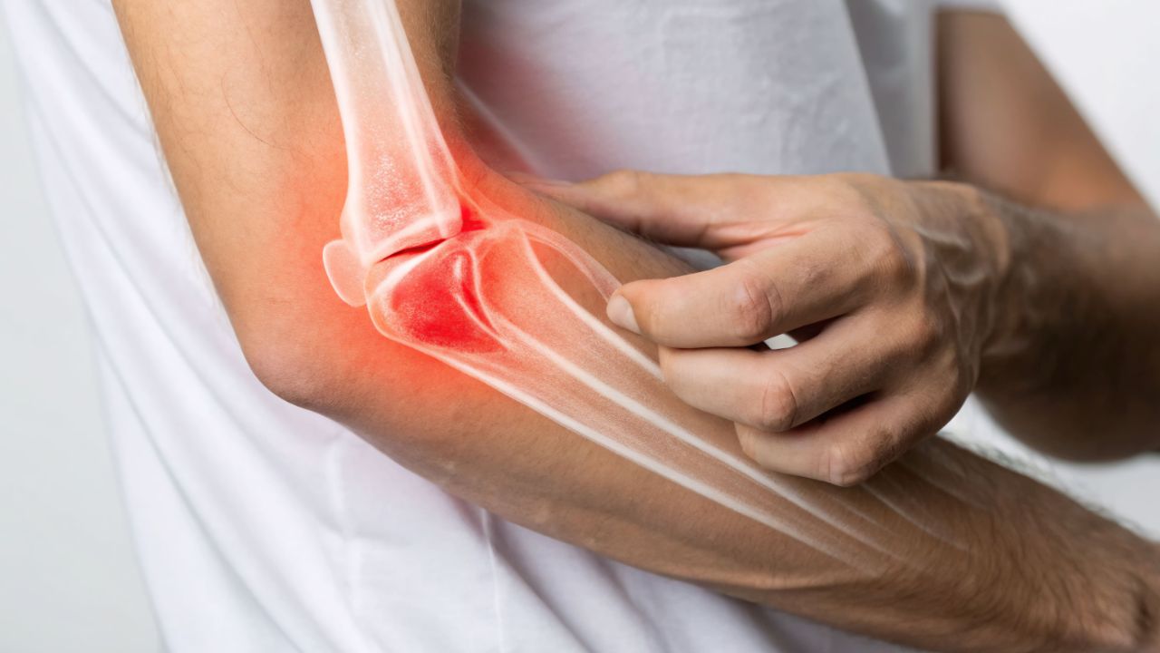 Incapacidad permanente total por tendinitis