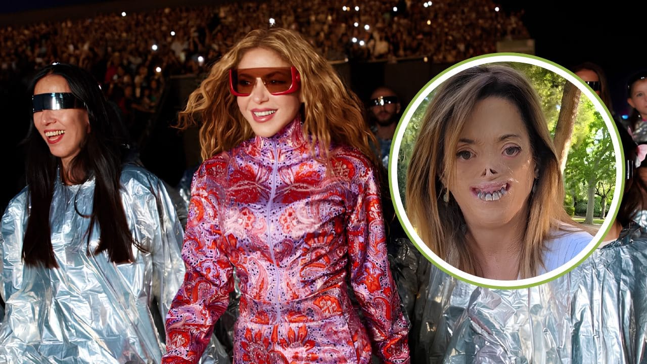 Fide Mirón pide a Shakira salir en el paseillo de su concierto para visibilizar a las personas con discapacidad y con enfermedades raras